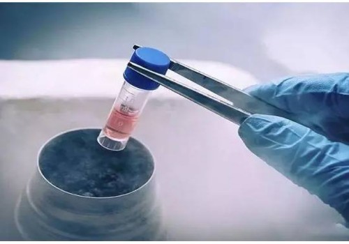圆头精子症也能做试管，成功率并不低